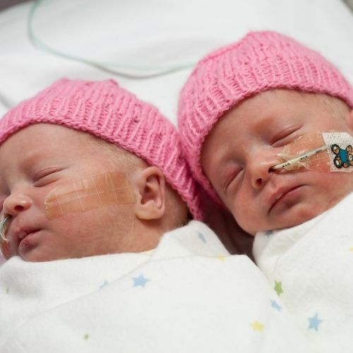 gemelos prematuros-hemiparesia-infantil