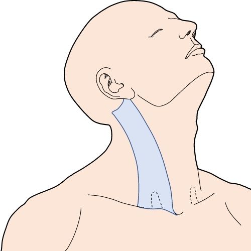 musculo esternocleidomastoideo